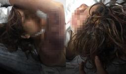 امرأة عذبها زوجها في أورفا التركية