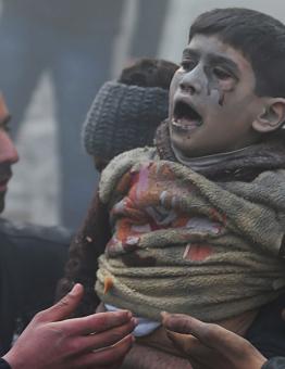 طفل سوري جريح