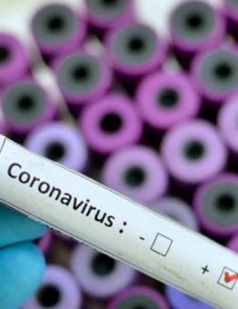 إجراءات احترازية لمنع انتشار فيروس كورونا حول العالم