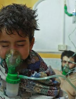طفل يتلقى العلاج في بعد التعرض لهجوم كيماوي في سوريا