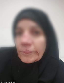 امرأة سورية تتعرض للضرب بوحشيه على يد تركي في إزمير