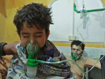 طفل يتلقى العلاج في بعد التعرض لهجوم كيماوي في سوريا