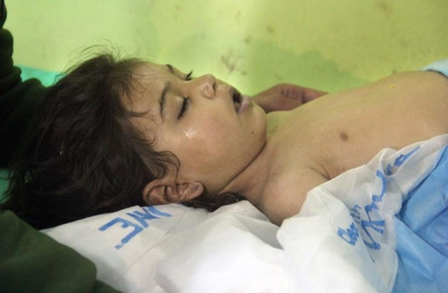 ضحايا كيماوي الأسد